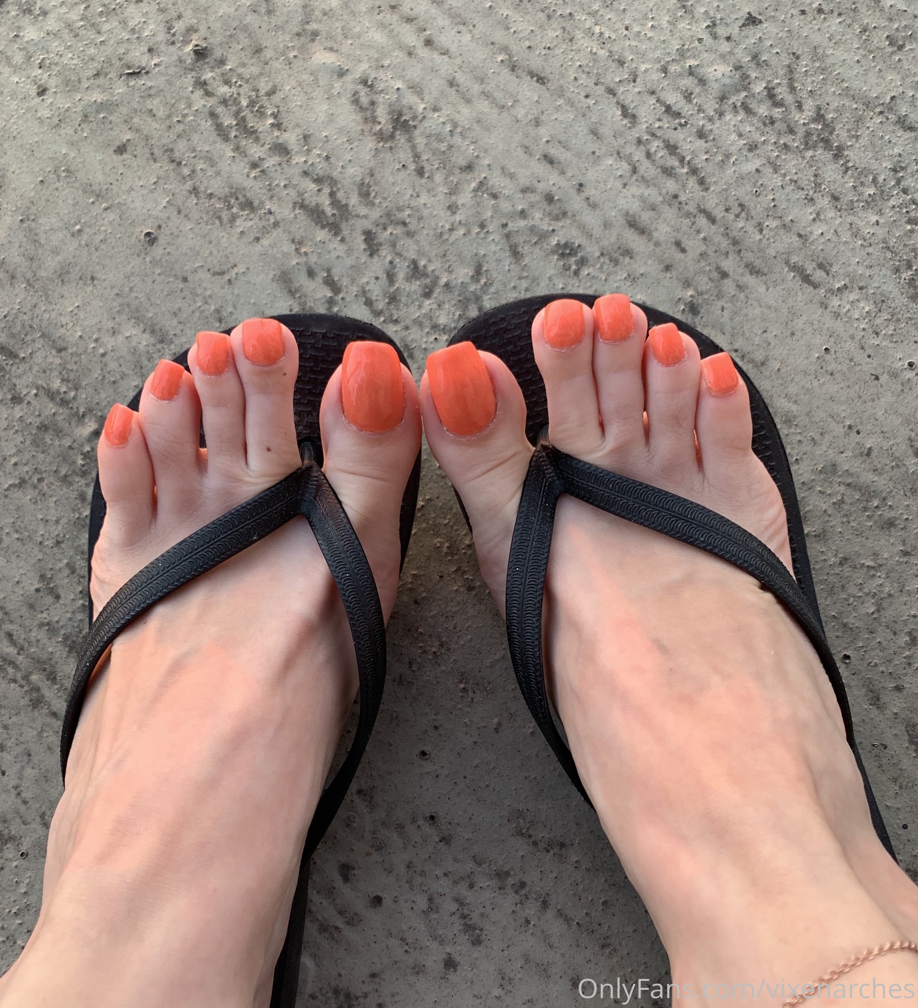 vixenarches feet