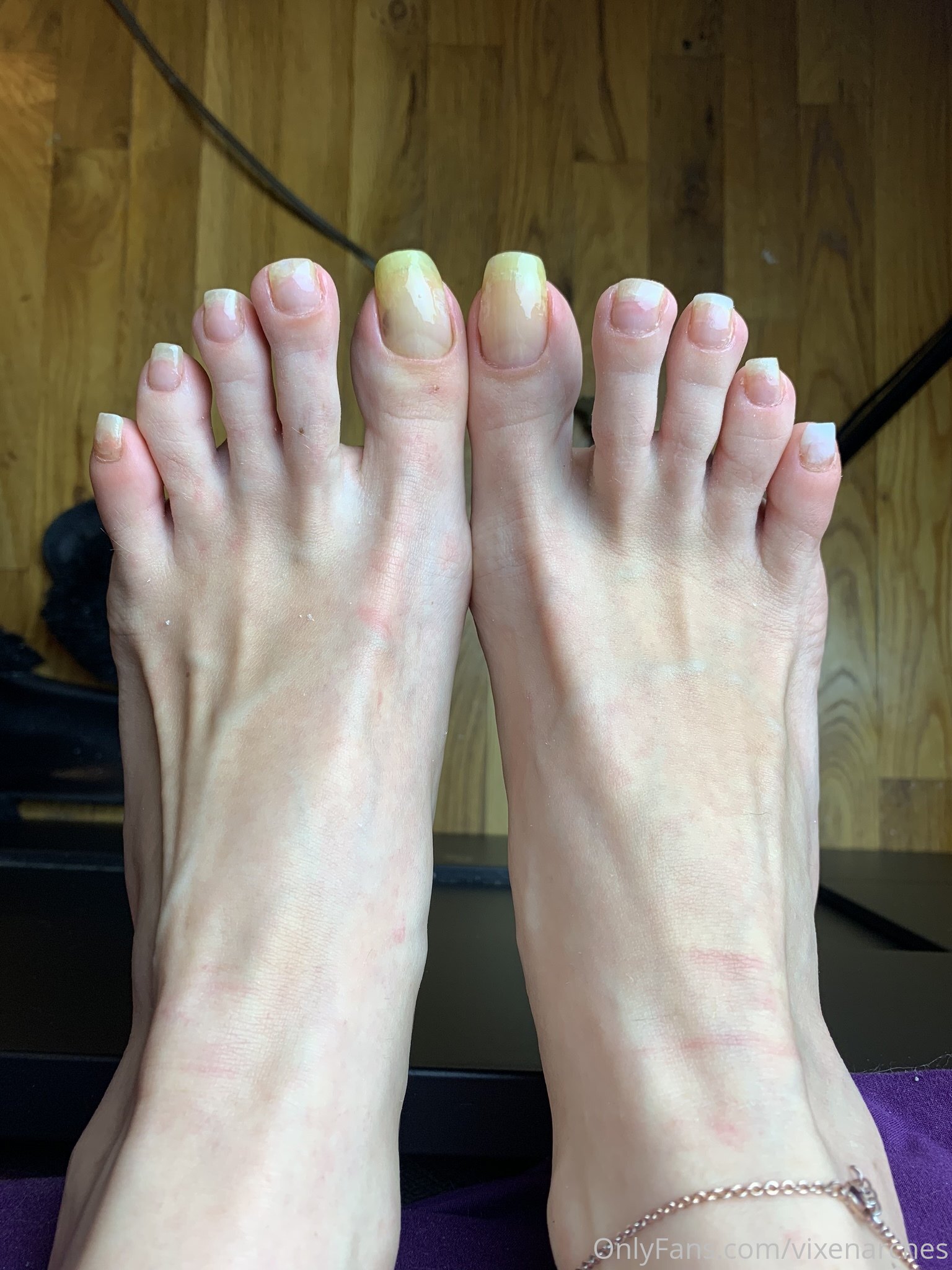 vixenarches feet