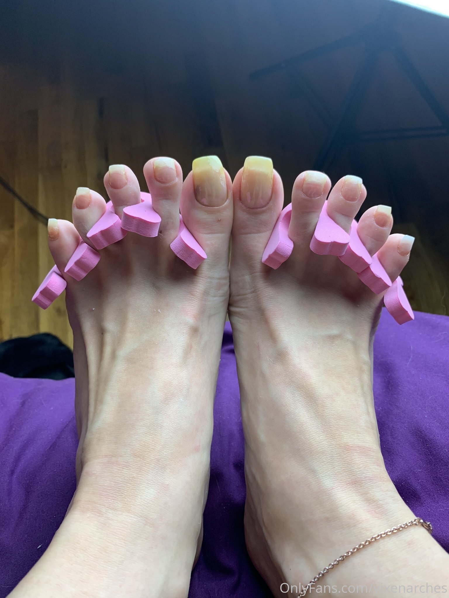 vixenarches feet