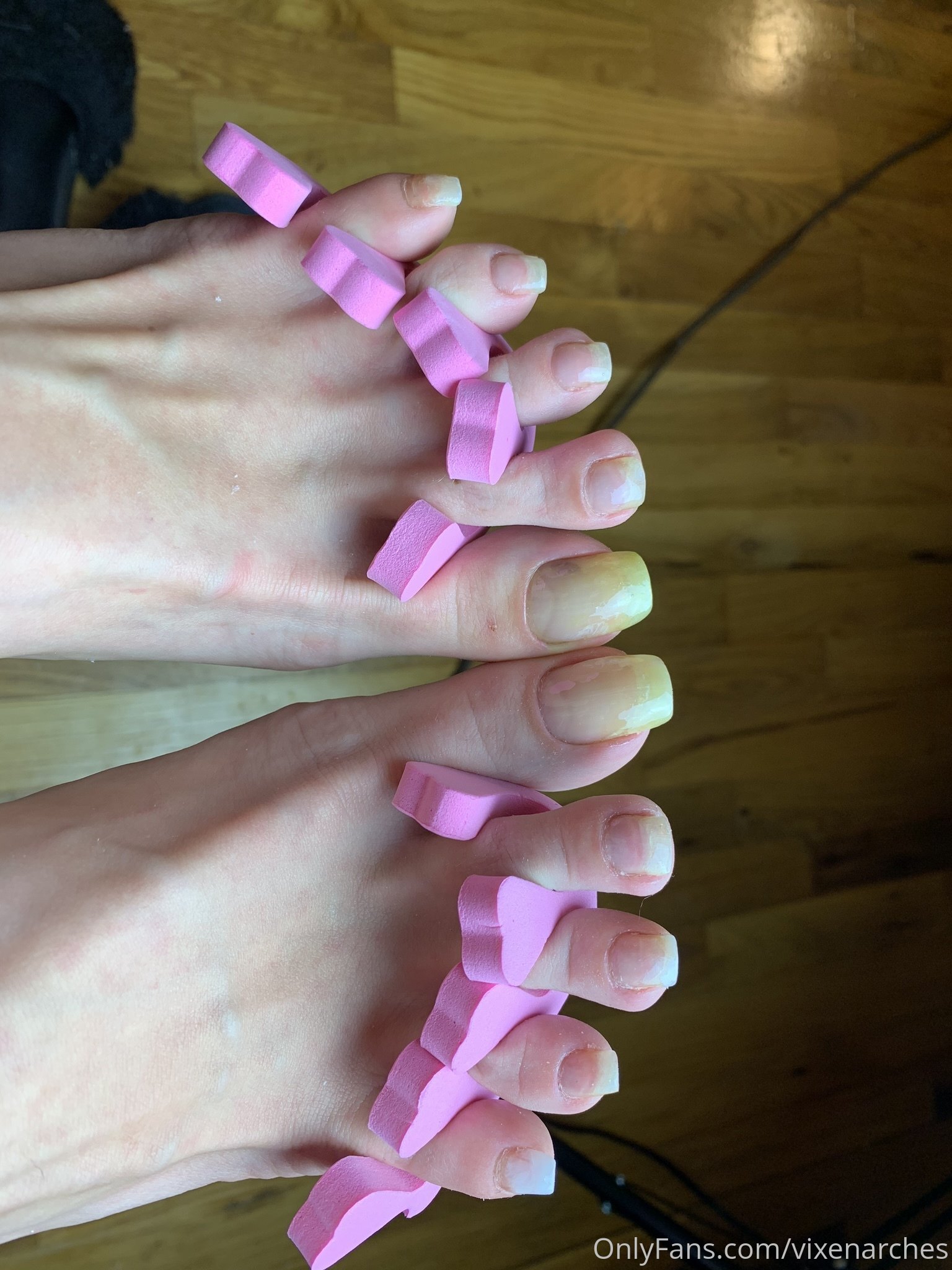 vixenarches feet