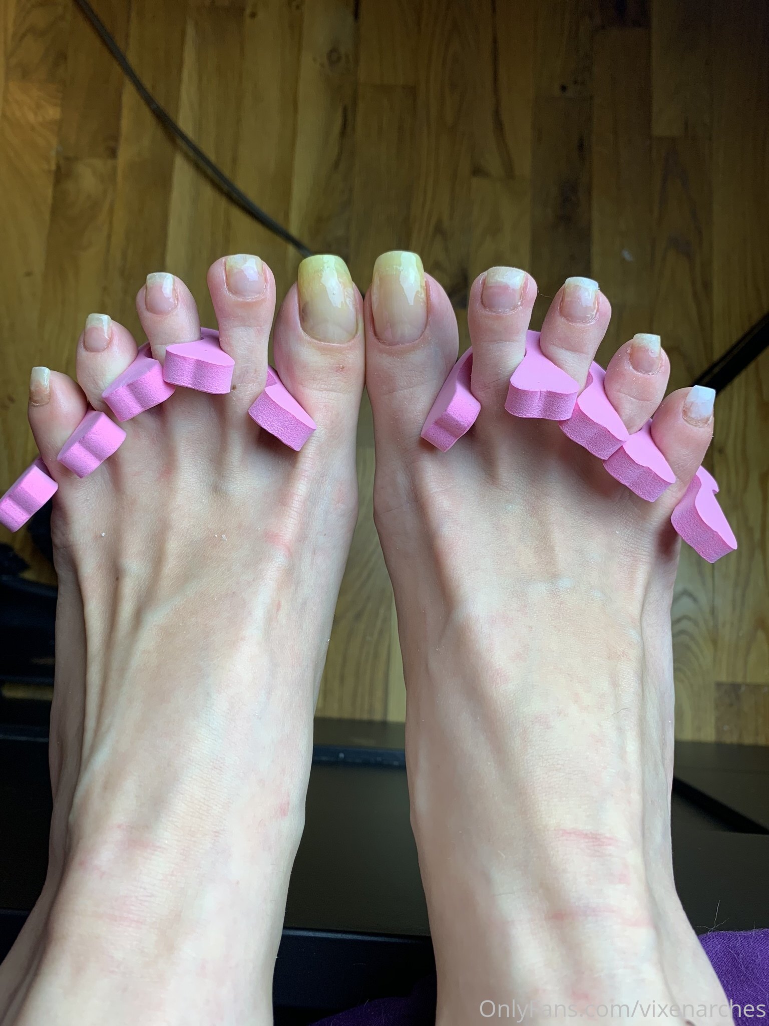 vixenarches feet