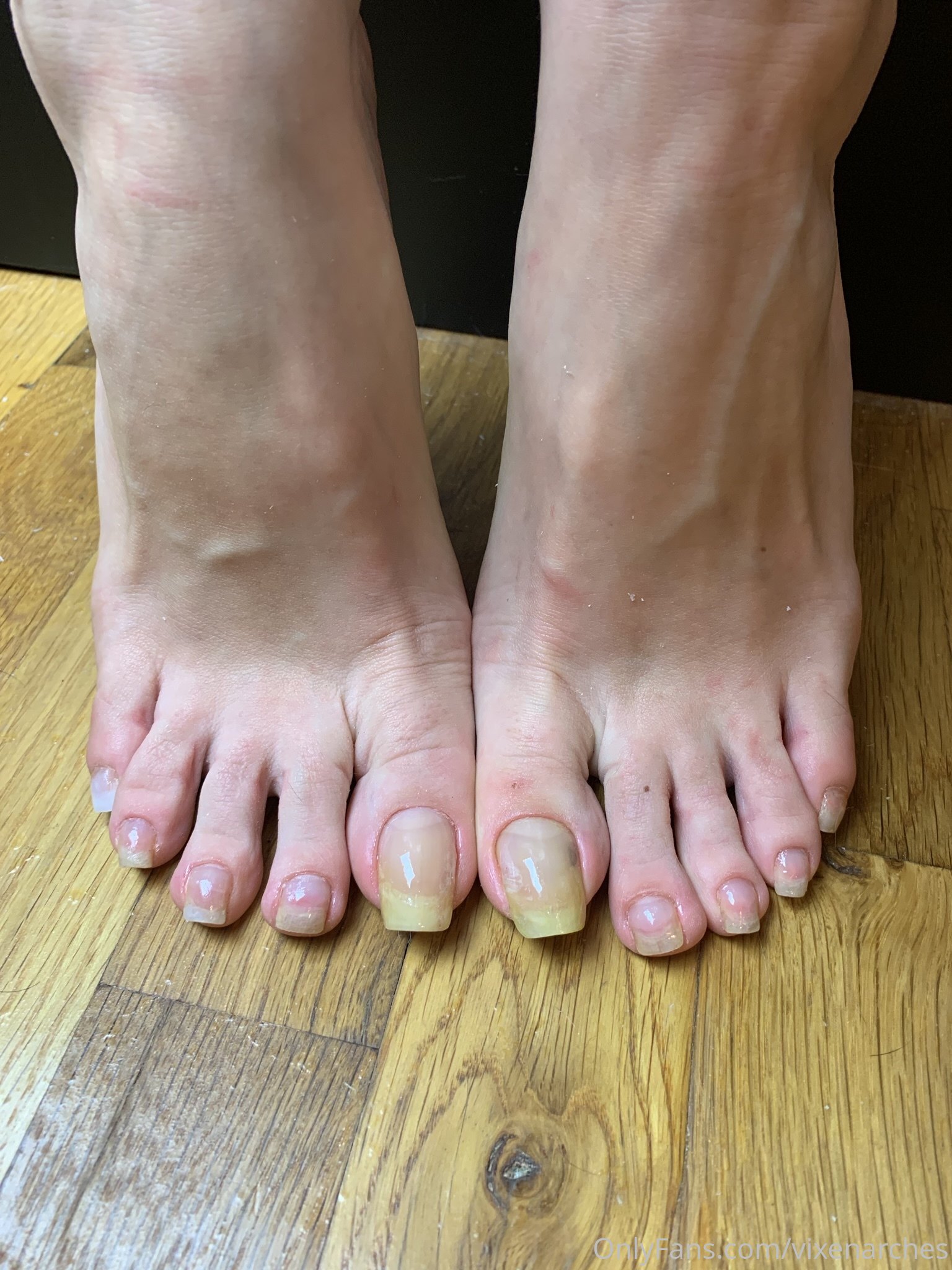 vixenarches feet