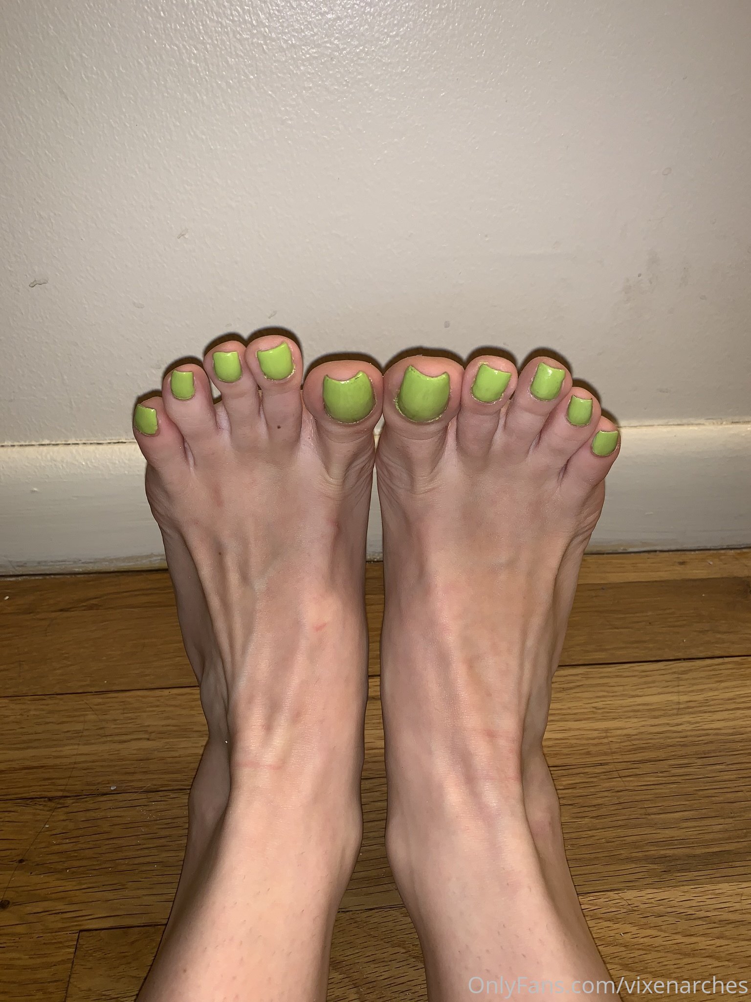 vixenarches feet