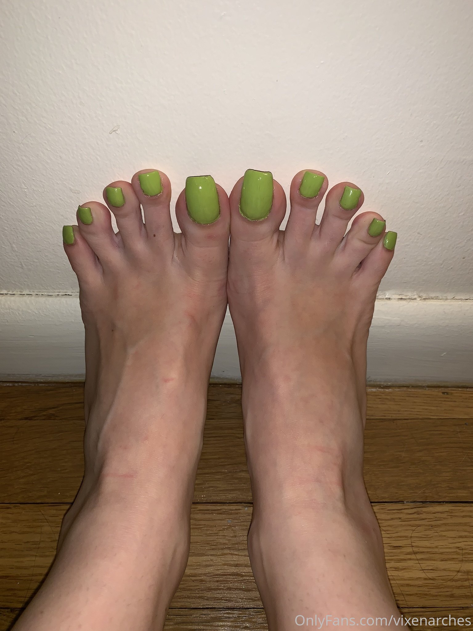 vixenarches feet