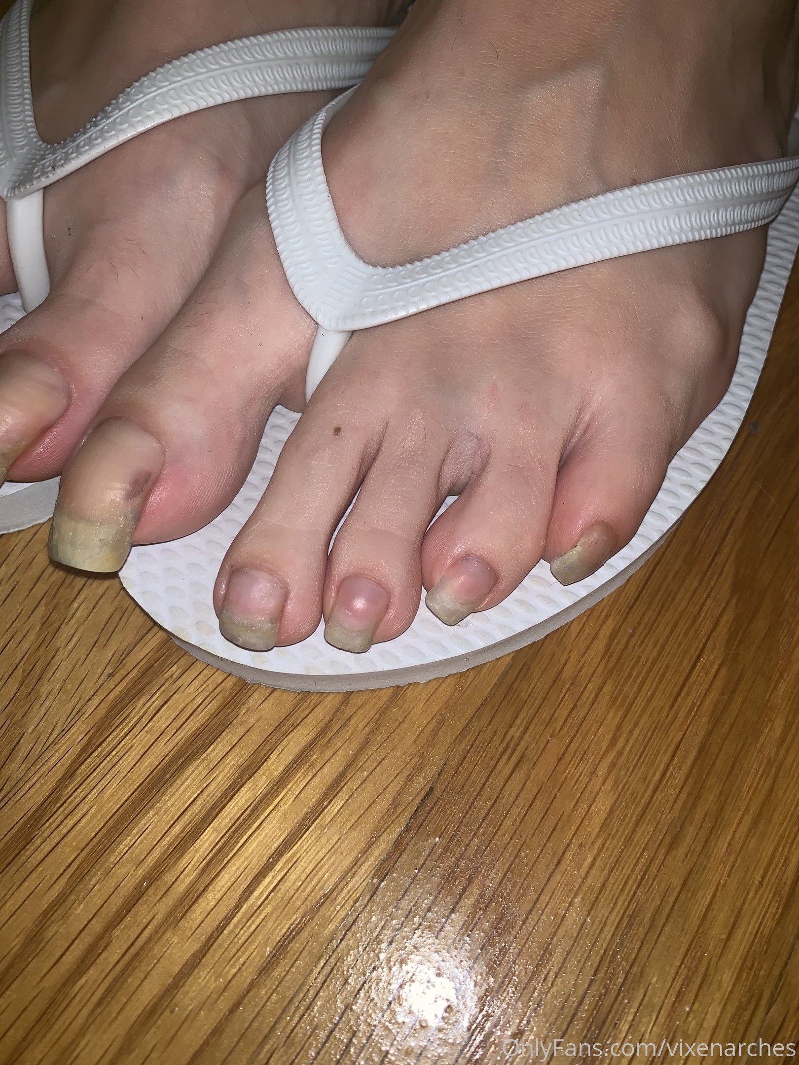 vixenarches feet