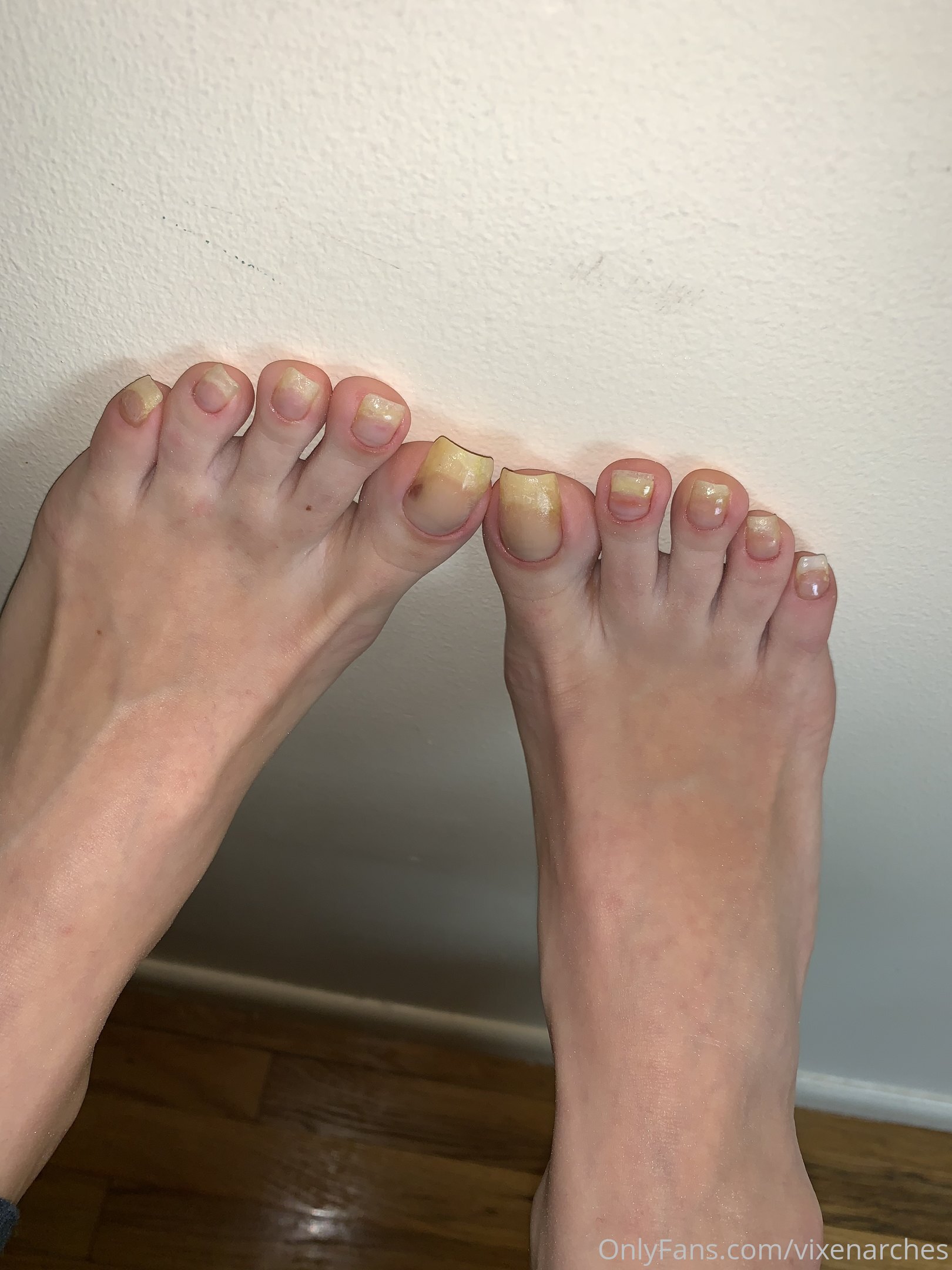 vixenarches feet