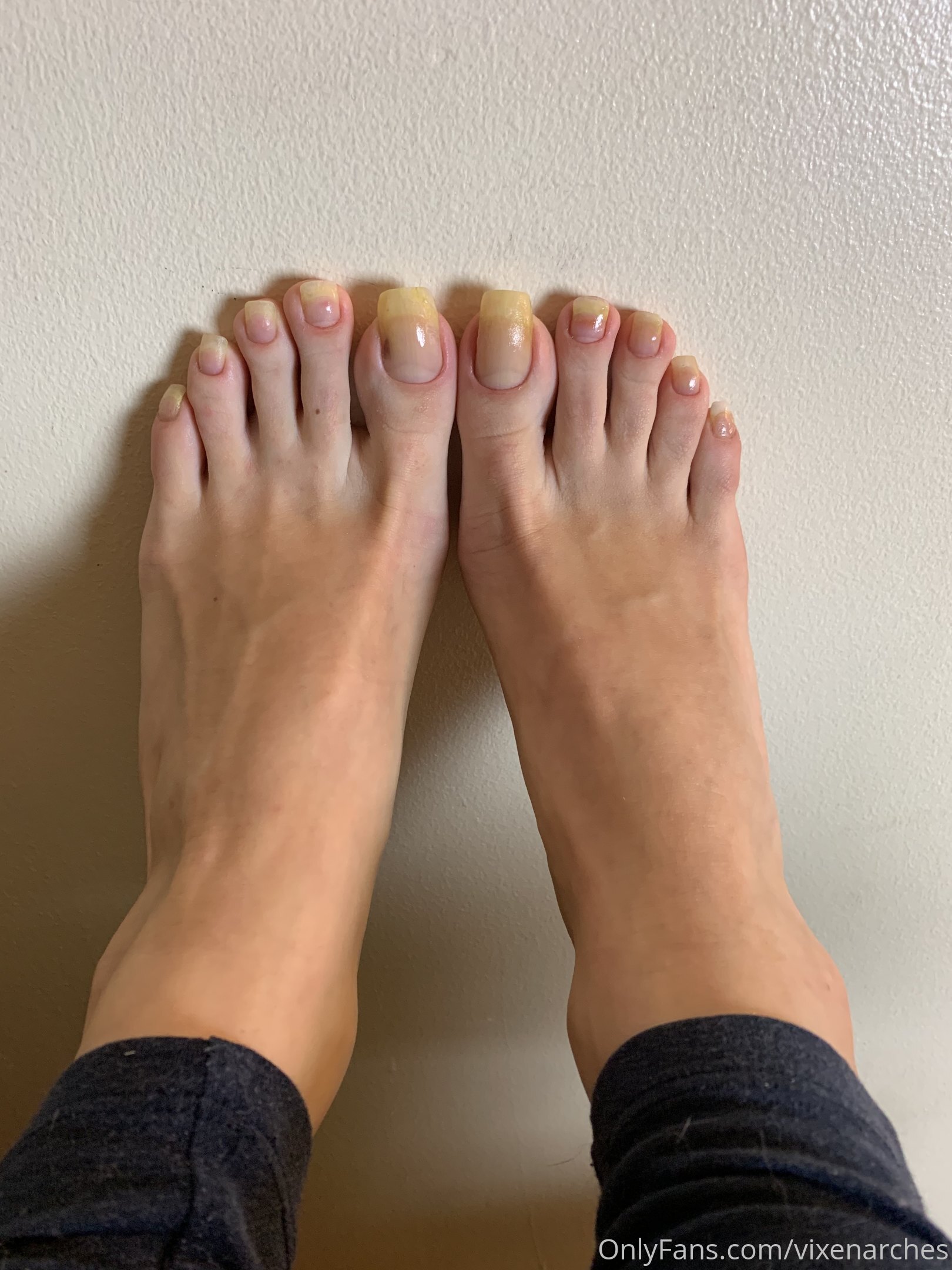 vixenarches feet