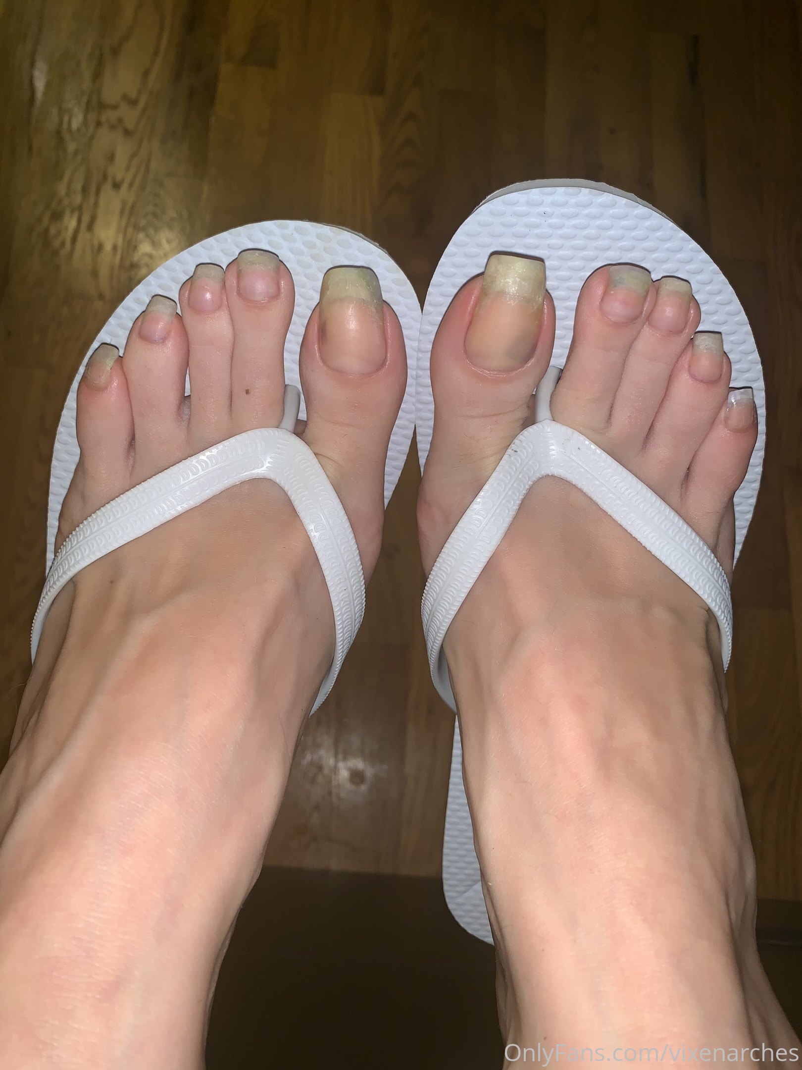 vixenarches feet