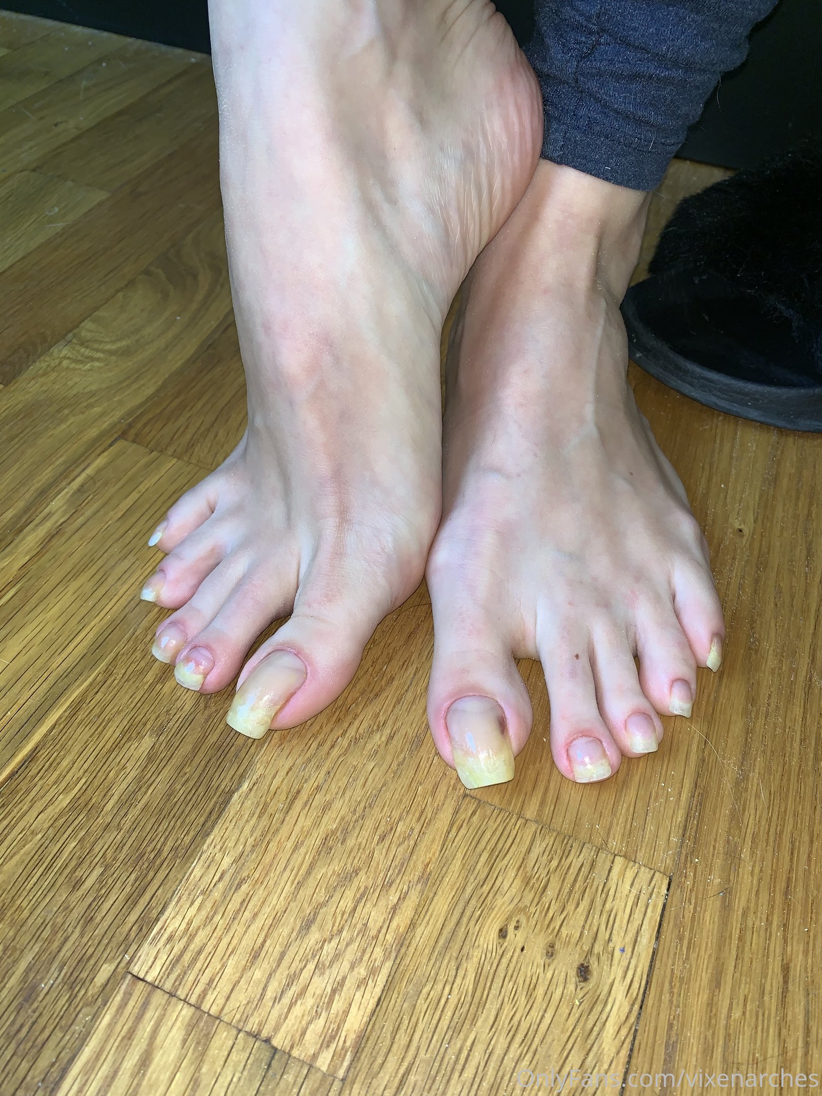 vixenarches feet