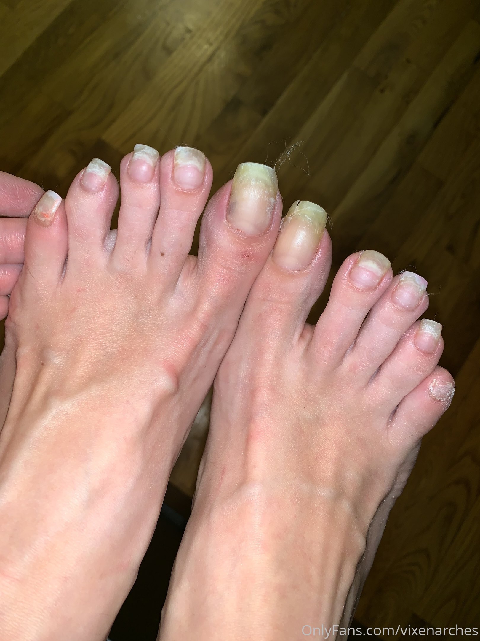 vixenarches feet