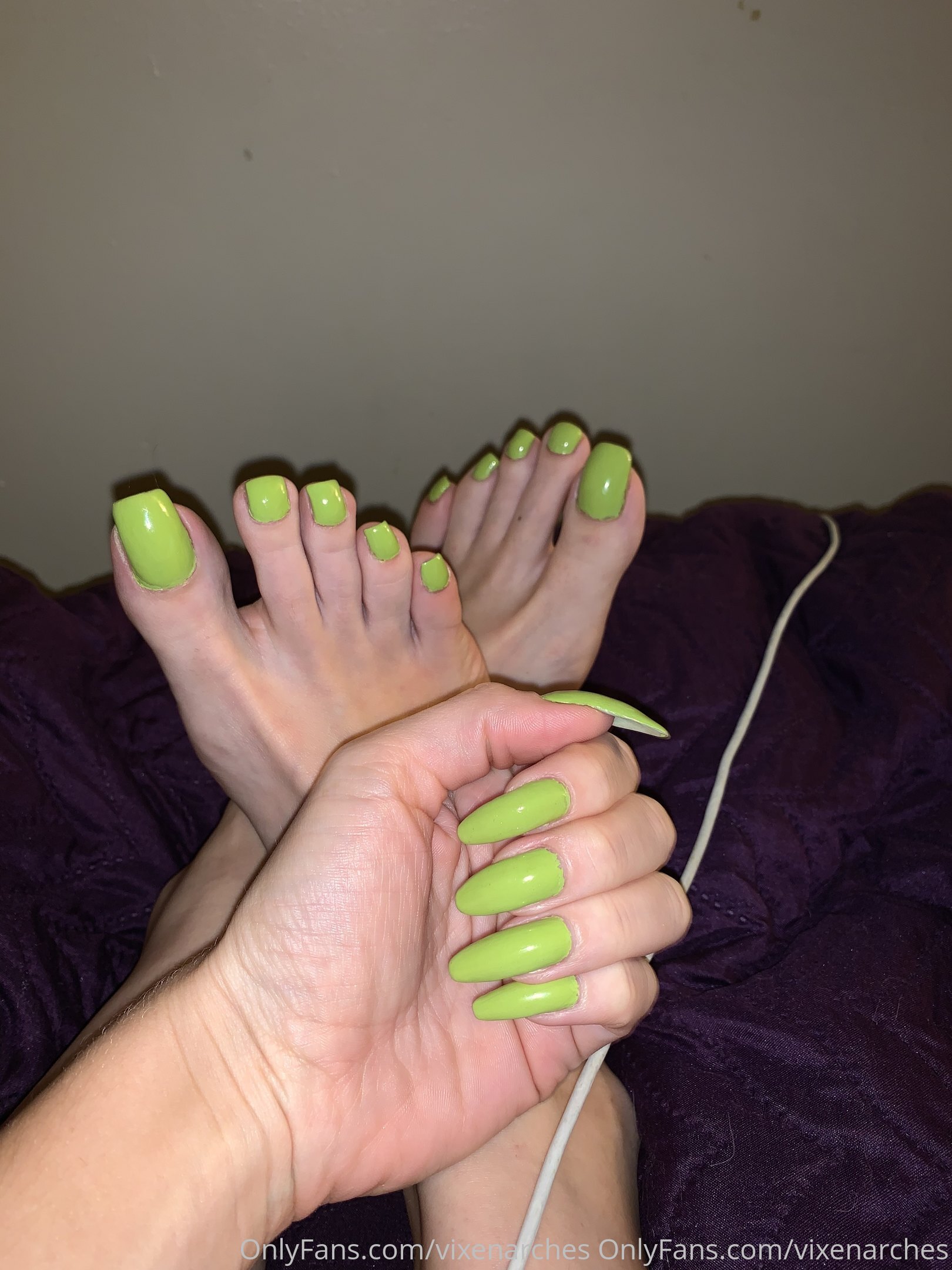 vixenarches feet