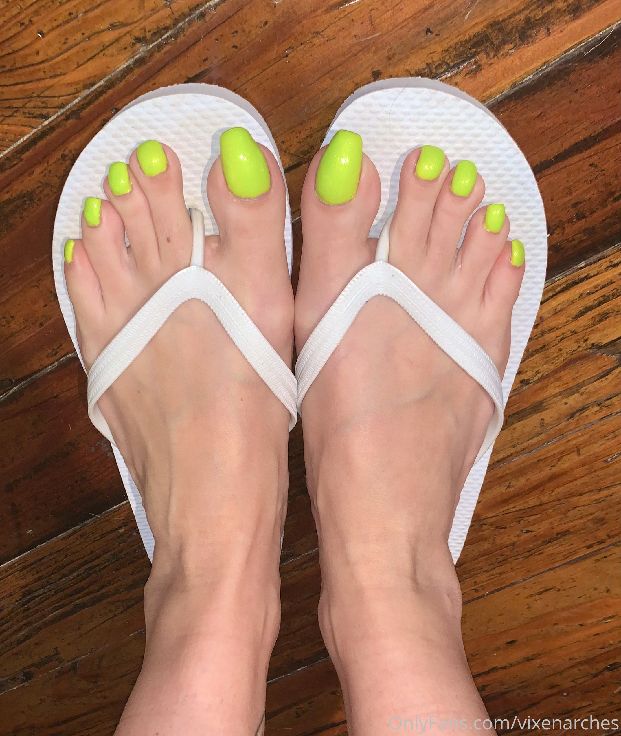 vixenarches feet