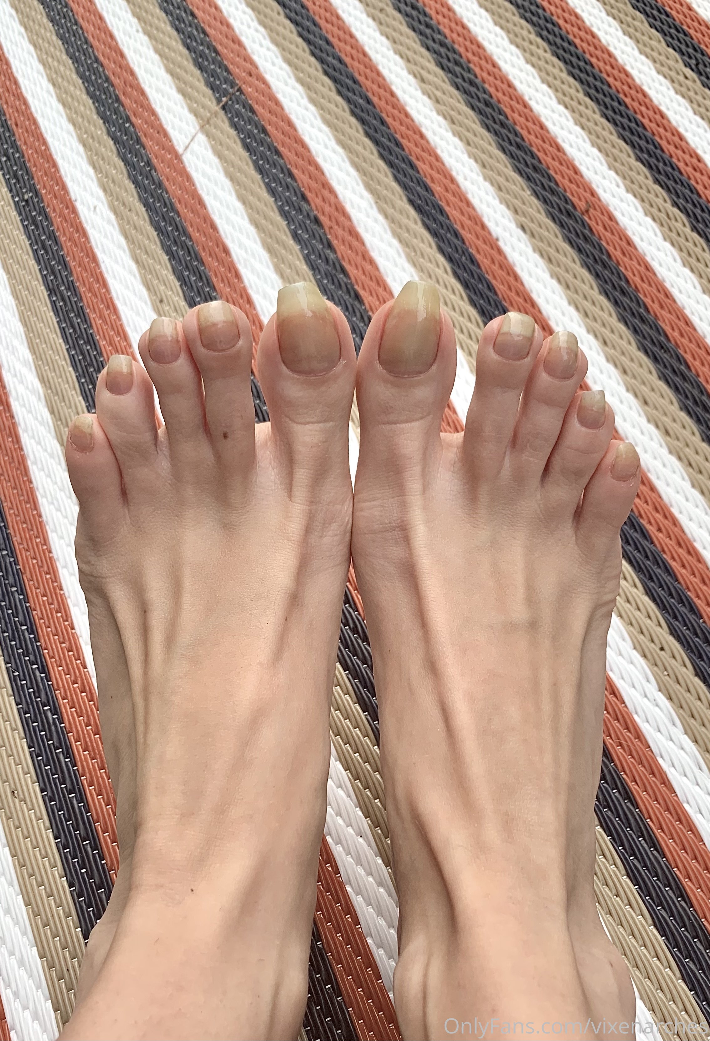 vixenarches feet