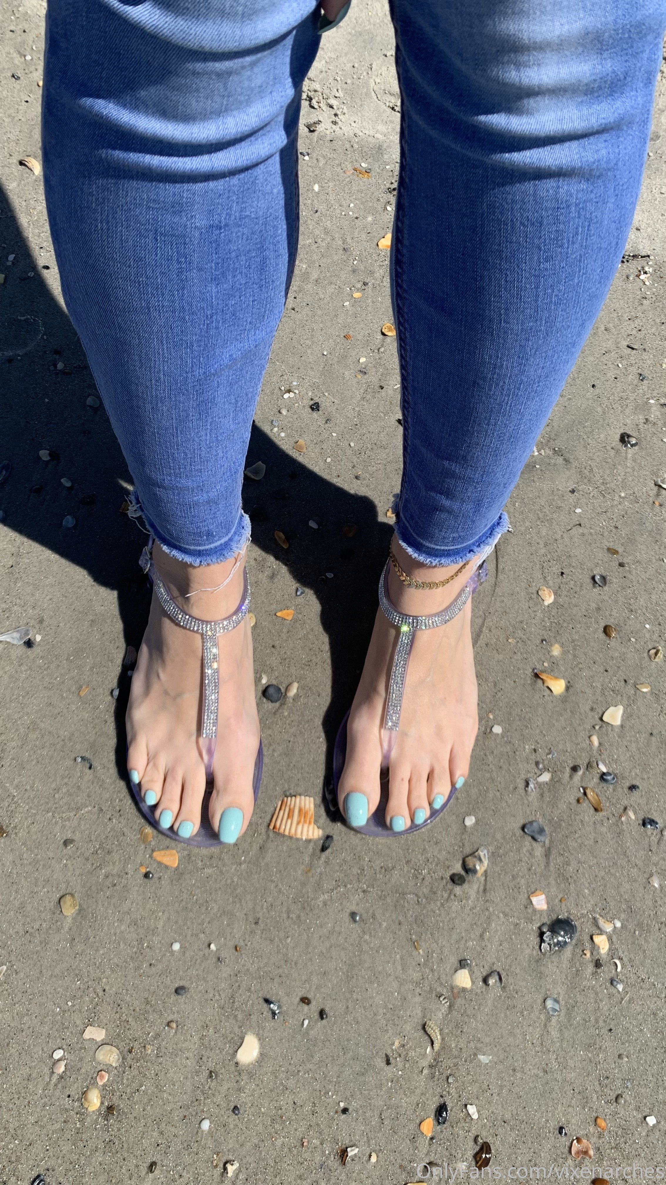 vixenarches feet