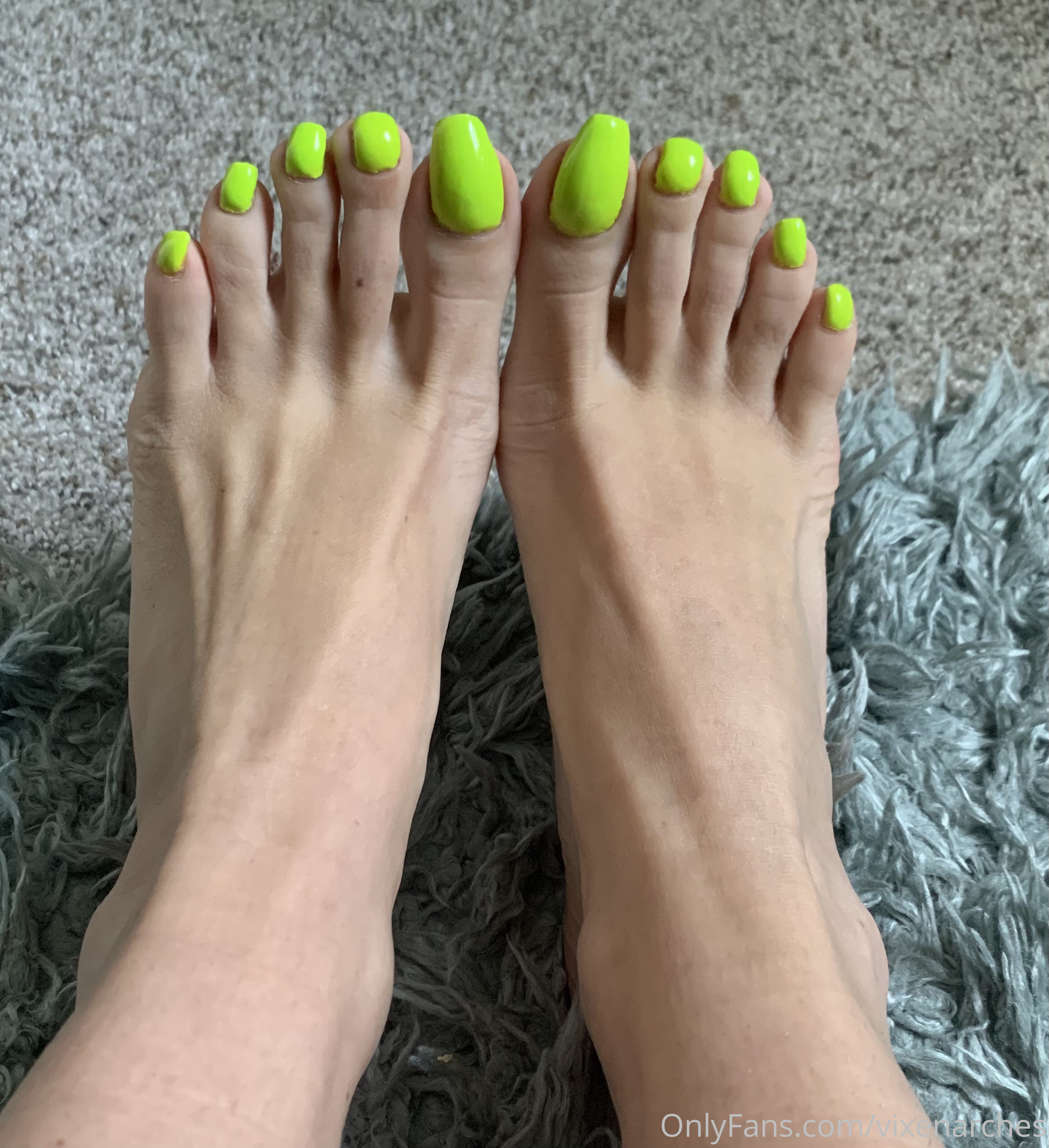 vixenarches feet