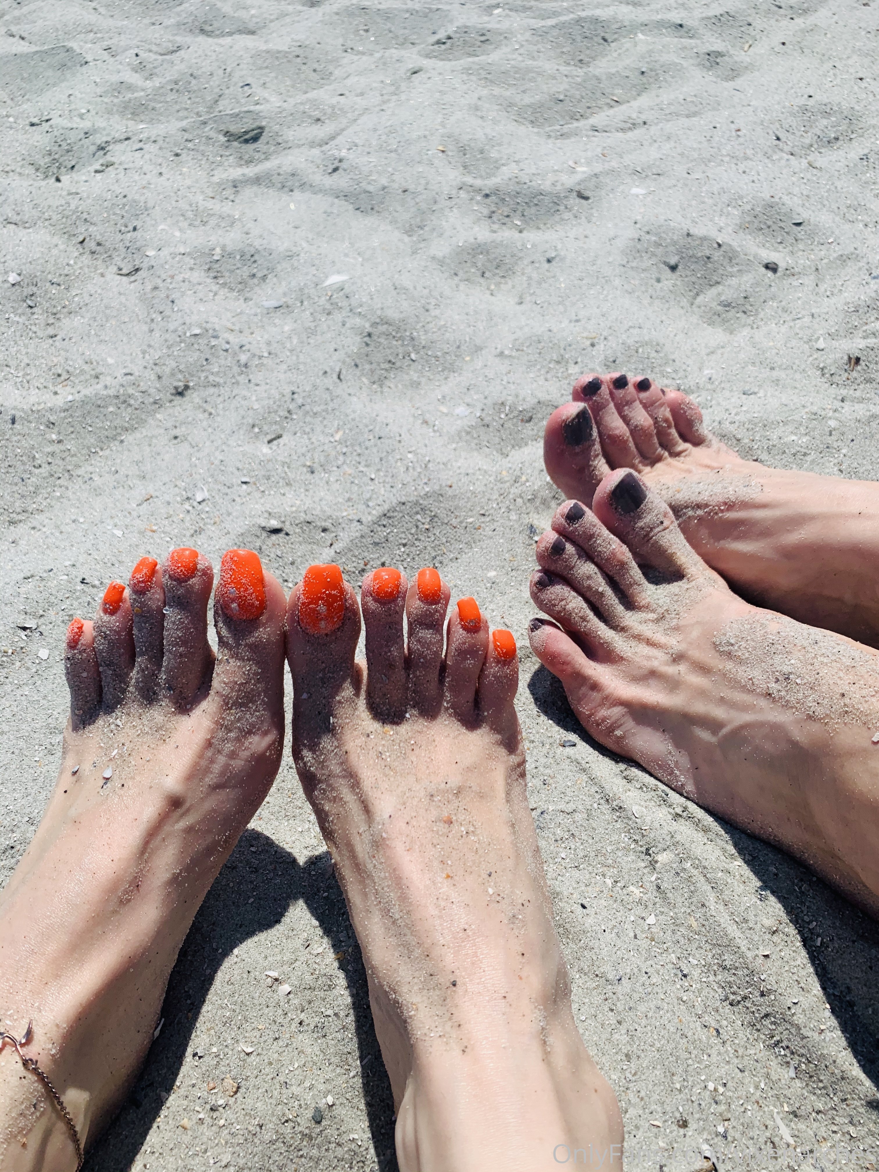 vixenarches feet