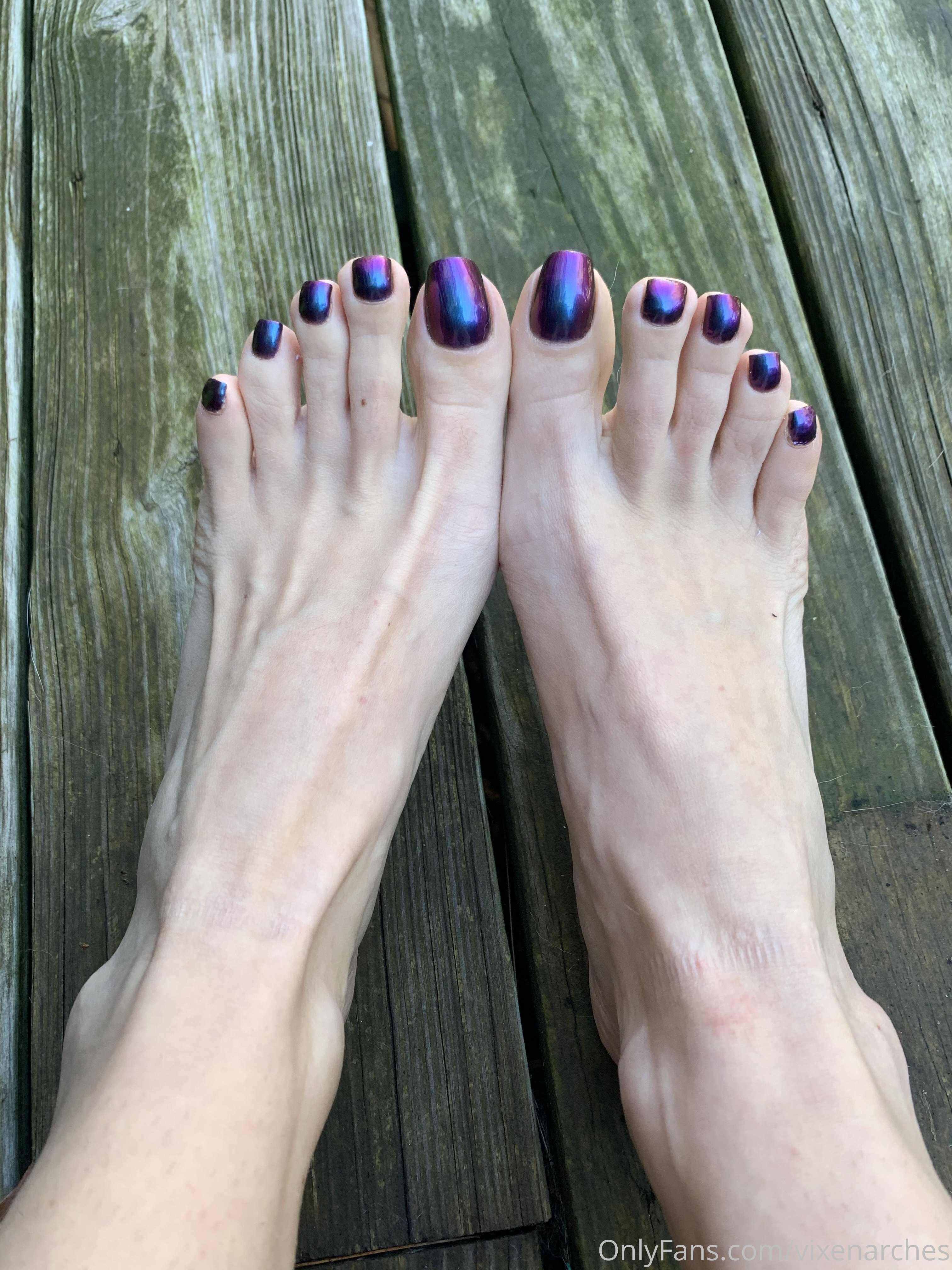 vixenarches feet