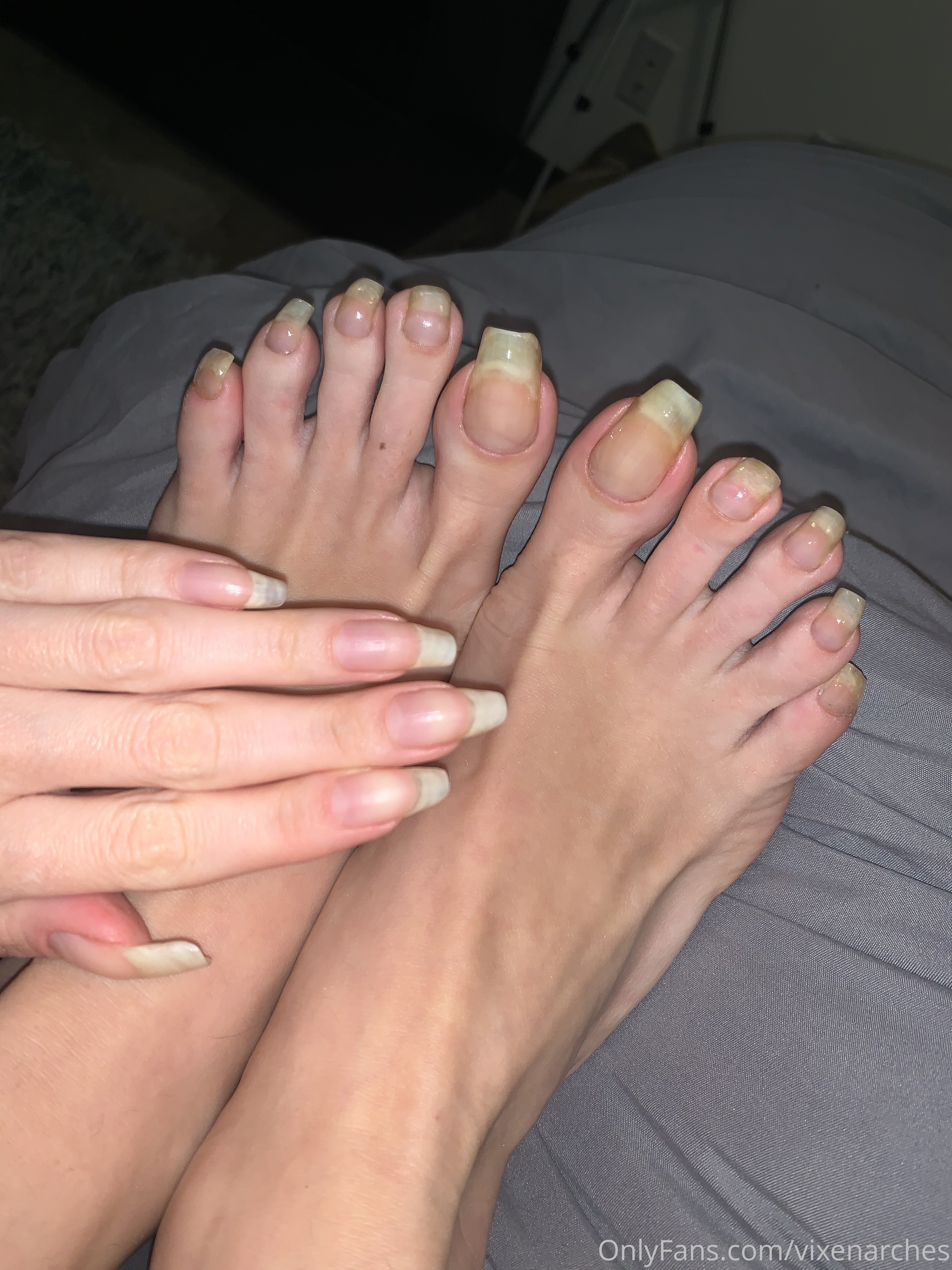 vixenarches feet