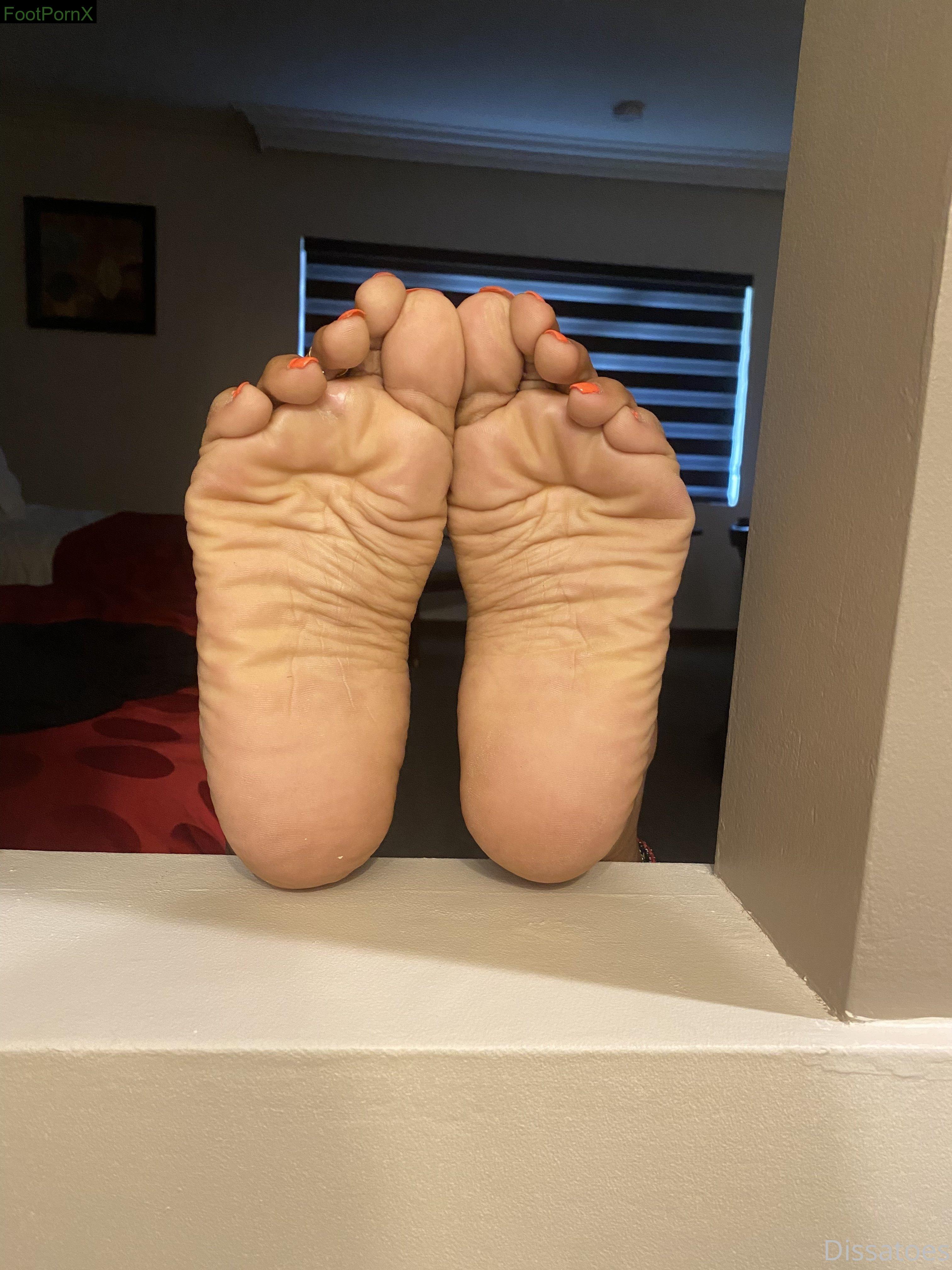 dissatoes feet