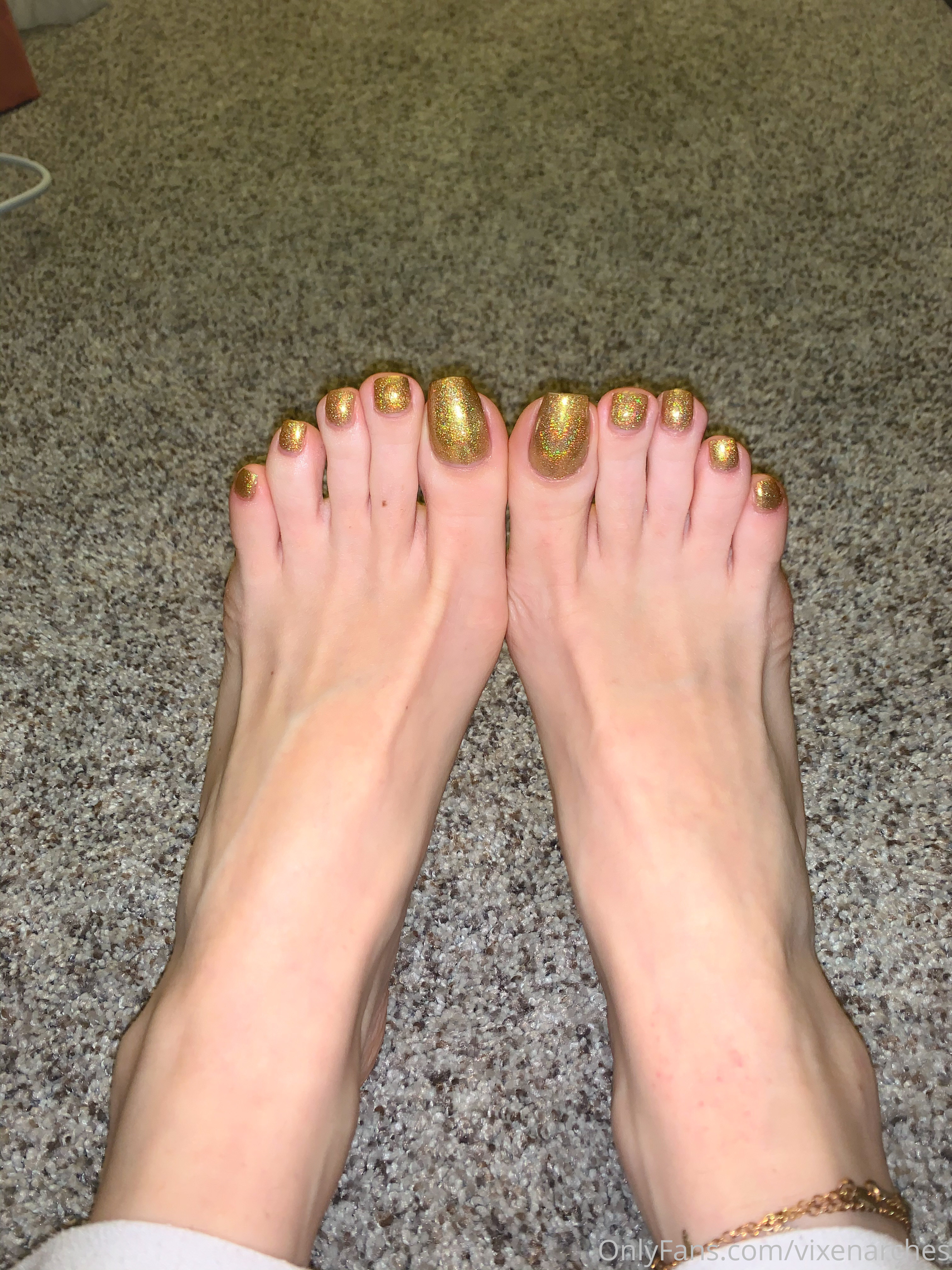 vixenarches feet