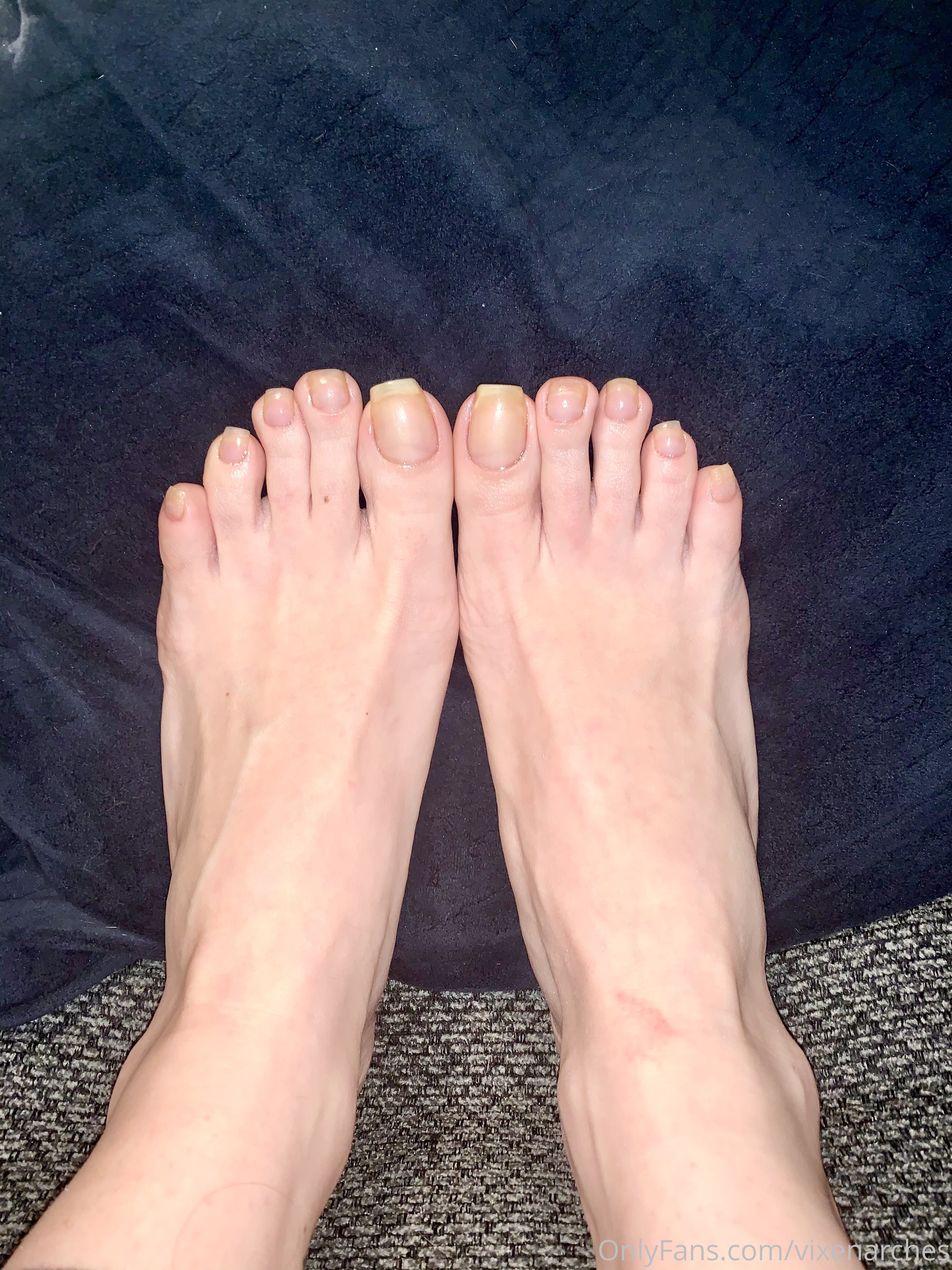 vixenarches feet