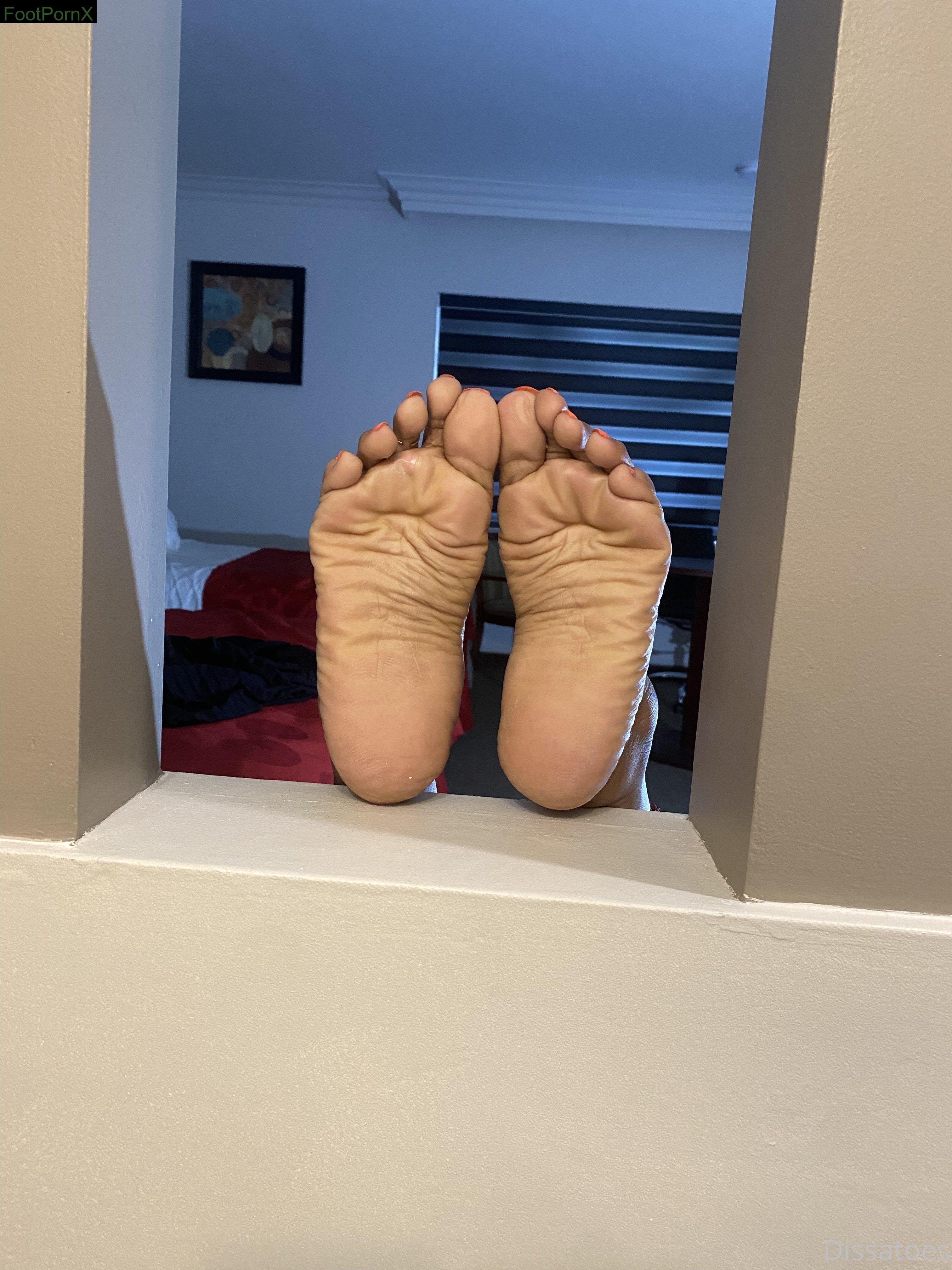 dissatoes feet